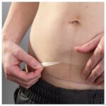 Lifestyle_image Lansinoh Hydrogel Keizersnede Patch 1