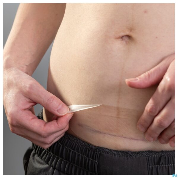 Lifestyle_image Lansinoh Hydrogel Keizersnede Patch 1