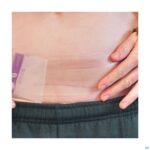 Lifestyle_image Lansinoh Hydrogel Keizersnede Patch 1