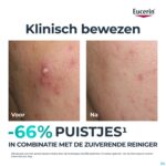 Lifestyle_image Eucerin Dermopure Clinic.triple Corrig.fluide 40ml