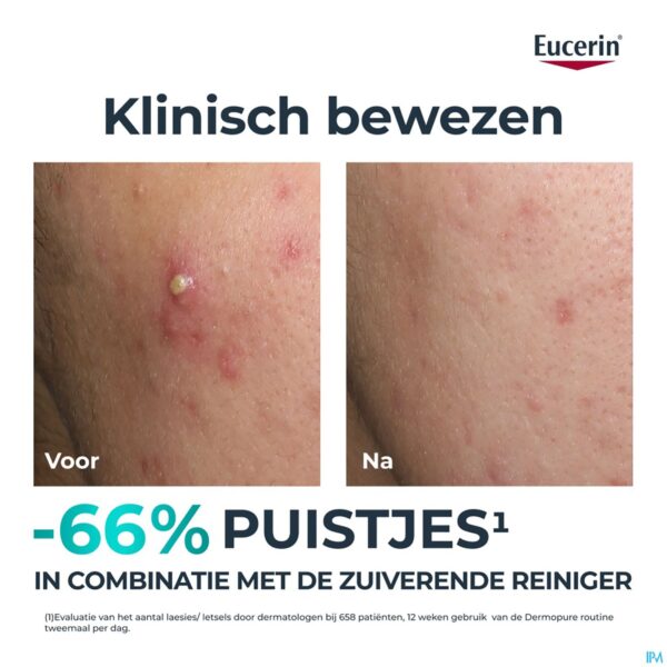 Lifestyle_image Eucerin Dermopure Clinic.triple Corrig.fluide 40ml