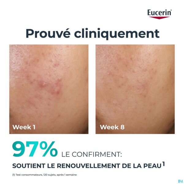 Lifestyle_image Eucerin Dermopure Clinic.peel.10 Nachtverzorg.40ml Lifestyle_image Eucerin Dermopure Clinic.peel.10 Nachtverzorg.40ml