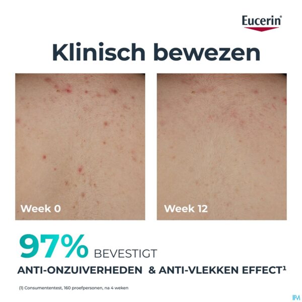 Lifestyle_image Eucerin Dermopure Clinic.corrig.lichaamsverz.200ml