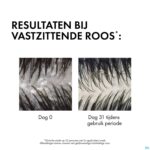 Lifestyle_image Vichy Dercos Sh A/roos Droog Haar Refill 390ml Lifestyle_image Vichy Dercos Sh A/roos Droog Haar Refill 390ml