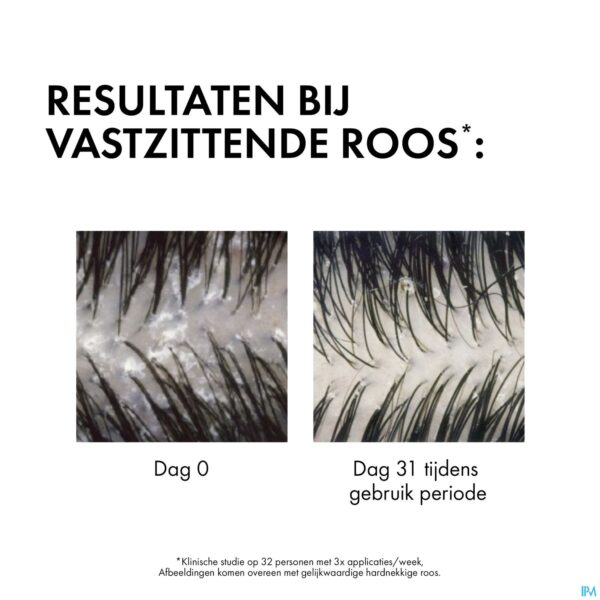 Lifestyle_image Vichy Dercos Sh A/roos Droog Haar Refill 390ml Lifestyle_image Vichy Dercos Sh A/roos Droog Haar Refill 390ml