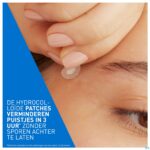 Lifestyle_image Cerave A/onzuiverheden Patches 22 Lifestyle_image Cerave A/onzuiverheden Patches 22