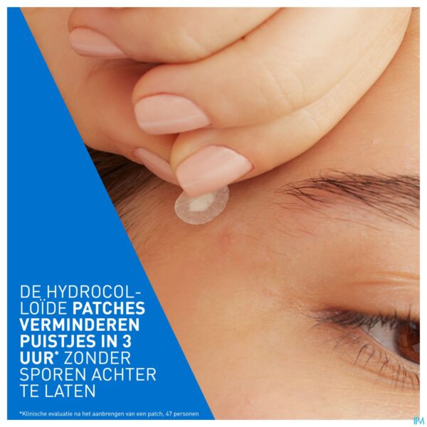 Lifestyle_image Cerave A/onzuiverheden Patches 22 Lifestyle_image Cerave A/onzuiverheden Patches 22