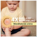 Lifestyle_image Dermatix Wondhelende Creme 32g