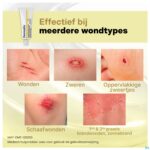 Lifestyle_image Dermatix Wondhelende Creme 32g