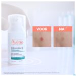 Lifestyle_image Avene Cleanance Comedomed+ 30ml