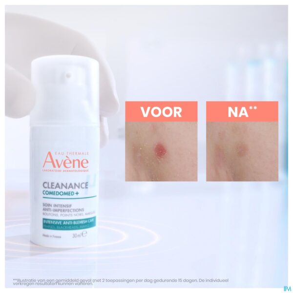 Lifestyle_image Avene Cleanance Comedomed+ 30ml