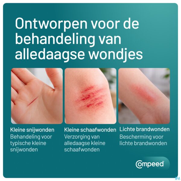 Lifestyle_image Compeed Smartskin Multibles Med 9