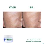 Lifestyle_image Klorane Gezicht Korenbloem Watercreme 50ml
