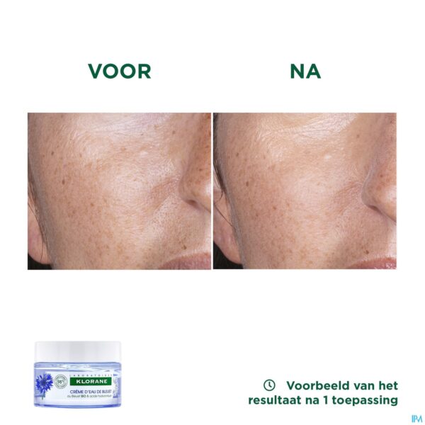 Lifestyle_image Klorane Gezicht Korenbloem Watercreme 50ml