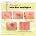Lifestyle_image Dermatix Wondhelende Spray 35ml