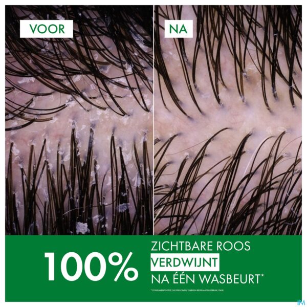 Lifestyle_image Vichy Dercos Sh A/roos 2in1 200ml