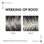 Lifestyle_image Vichy Dercos Sh A/roos Ds Droog Haar 200ml