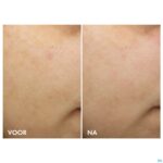 Lifestyle_image Vichy Liftactiv B3 Teint Nachtcr Retinol Pur 50ml