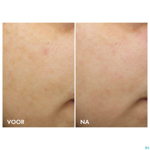 Lifestyle_image Vichy Liftactiv B3 Teint Nachtcr Retinol Pur 50ml