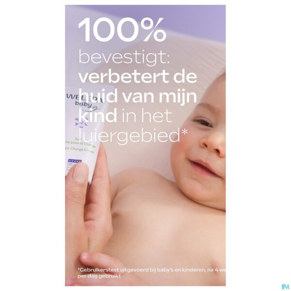 Lifestyle_image Weleda Baby 3in1 Billenbalsem Witte Malva 50ml