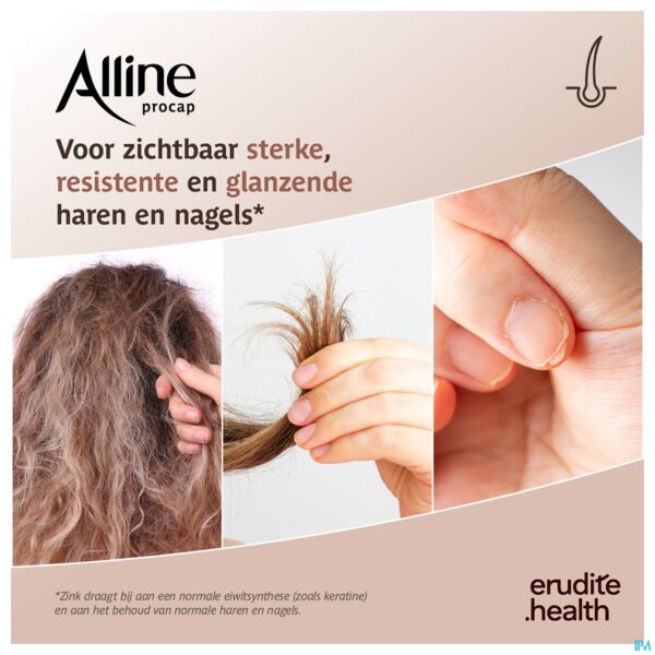 Lifestyle_image Alline Procap Caps 30